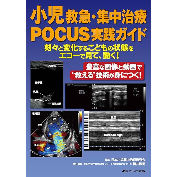 Amazon.co.jp: 小児救急 小児集中治療―救急外来・PICUの実践ルール